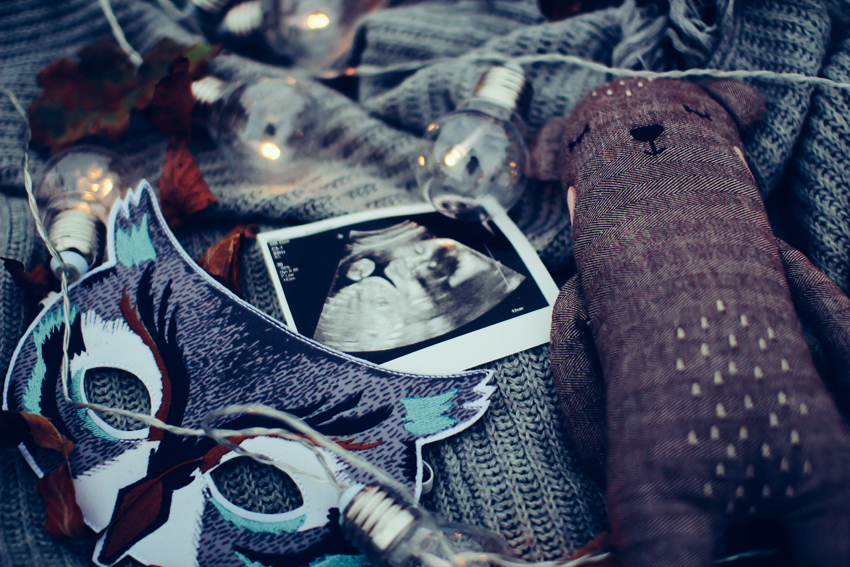 Zdjęcia z USG – najlepsza pamiątka po ciąży