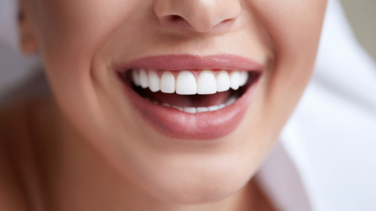 Bonding – szybki sposób na poprawę wyglądu zębów