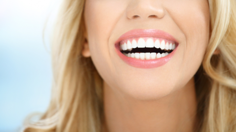 Poprawa estetyki zębów okiem ortodonty