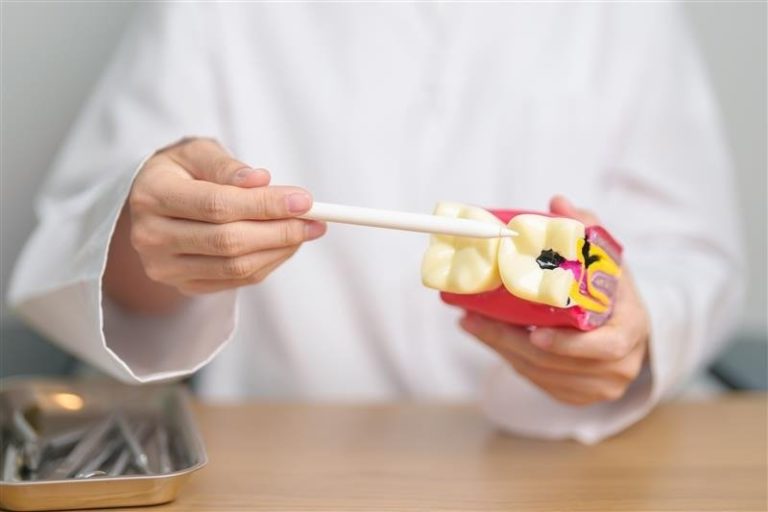 Próchnica nie pyta tylko o to, czy myjesz zęby. Pyta, co jesz i jak często to robisz