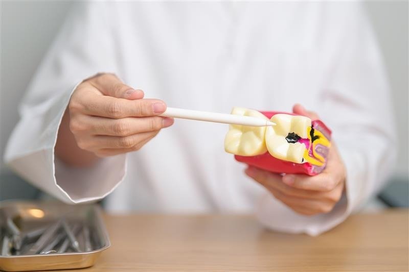 Próchnica nie pyta tylko o to, czy myjesz zęby. Pyta, co jesz i jak często to robisz